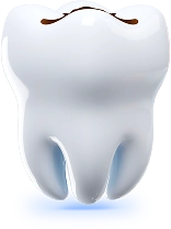 obturatie_dentara_mbl obturatie dentara plomba