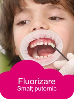 fluorizare