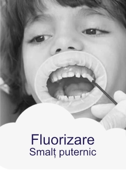 fluorizare