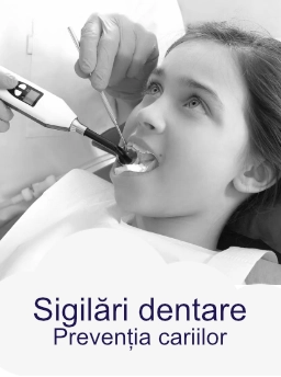 sigilari dentare